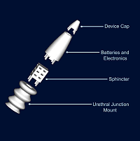 implantable urine control device